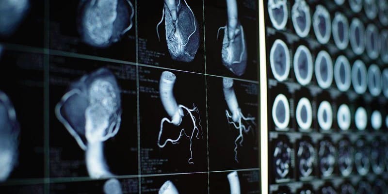 Penyakit Organ Dalam