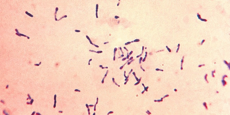 penyakit difteri pada anak - tanda penyakit difteri - penyebab penyakit difteri - cara mencegah penyakit difteri
