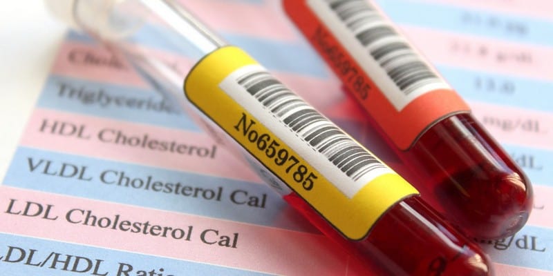 jeroan - makanan penyebab asam urat - makanan pantangan kolesterol