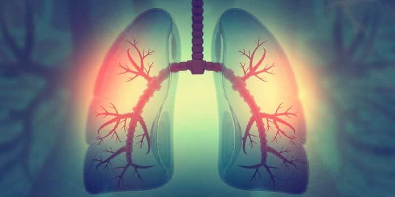 penyebab asthma - penyebab sesak nafas