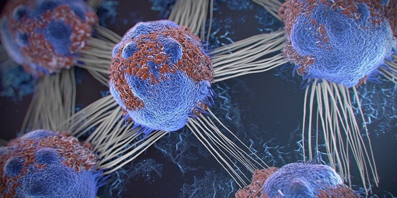 sel kanker - ciri-ciri kanker - jenis kanker