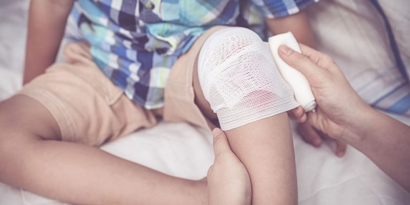 Ilustrasi Cara Mengobati Luka Memar