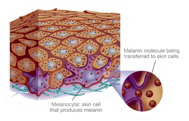 penyakit vitiligo - penyebab vitiligo - gejala vitiligo - bercak putih pada kulit - pengobatan vitiligo