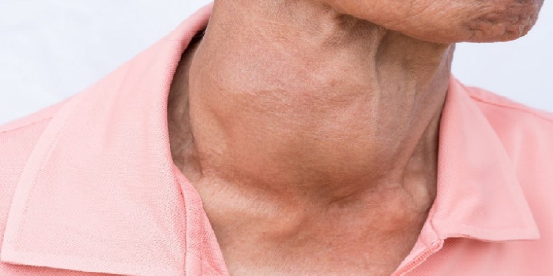 manfaat yodium - fungsi yodium - detoksifikasi