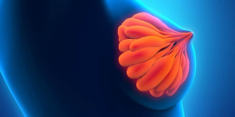 Ilustrasi penyebab mastitis, penumpukan ASI di payudara