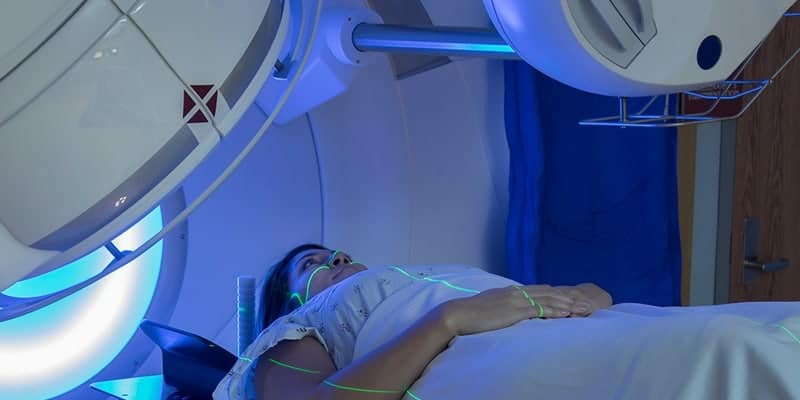 Ilustrasi terapi radiasi untuk tumor tiroid