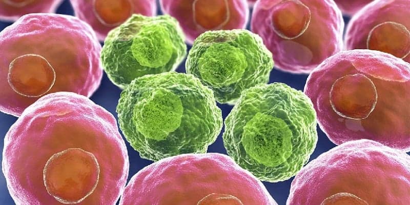 beda bentuk sel kanker dan bentuk sel normal