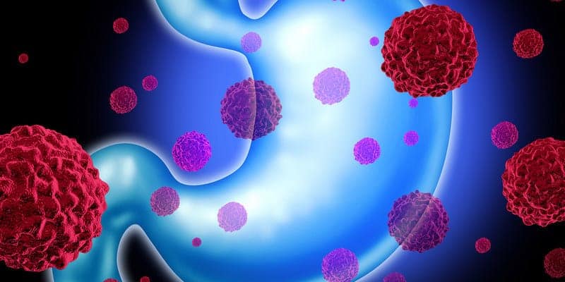 Resep herbal kanker lambung