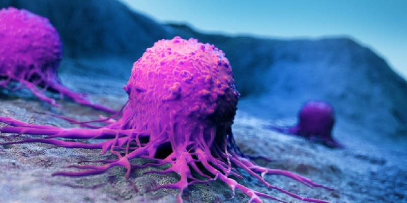 stadium dalam kanker