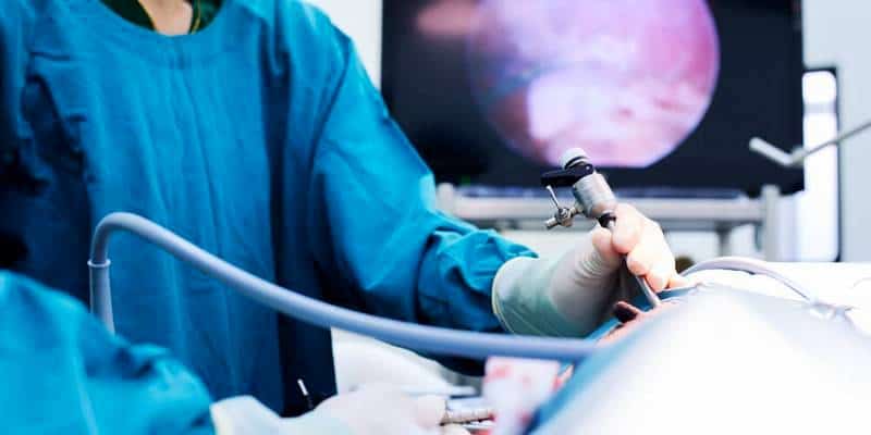 kolektomi laparoskopi