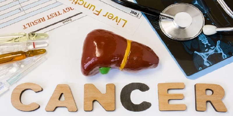 gejala kanker hati