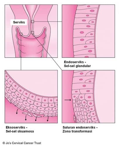 anatomi kanker serviks