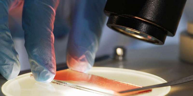 biopsi untuk gejala kanker penis