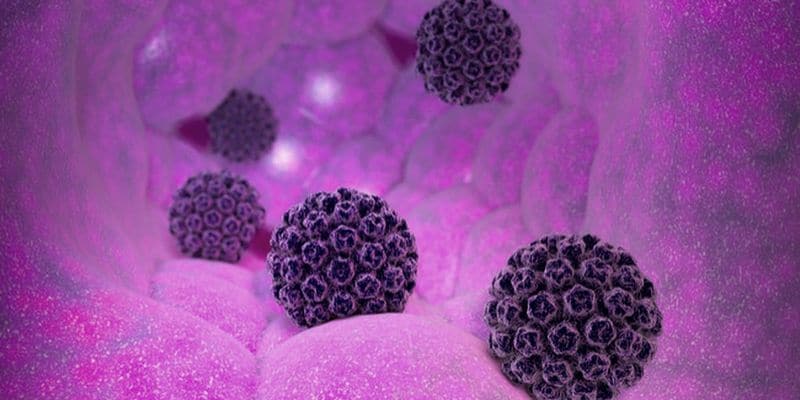 Virus Pemicu Kanker Serviks Bisa Menular pada Wanita Maupun Pria