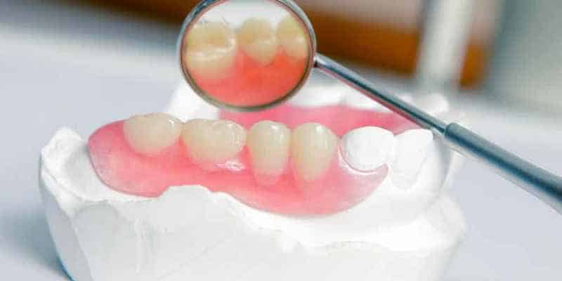 Dokter Membuat Gigi Palsu