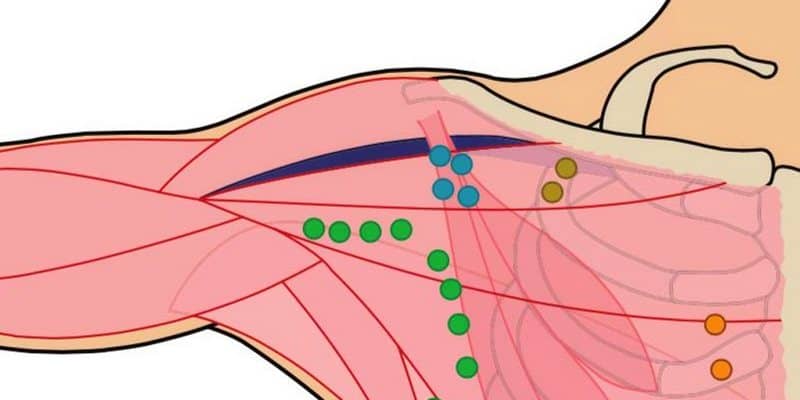 Kanker Limfoma Dapat Muncul di Kelenjar Getah Bening Ketiak