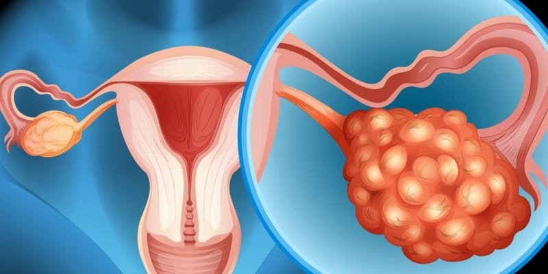 Ilustrasi Harapan Hidup Kanker Ovarium Stadium 4