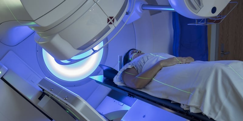 Ilustrasi Efek Samping Radioterapi Kanker Payudara