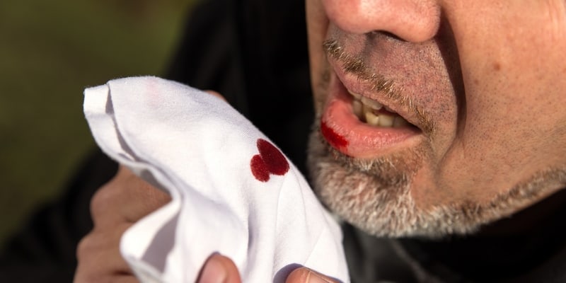 Ilustrasi Cara Deteksi Dini Kanker dari Gejalanya