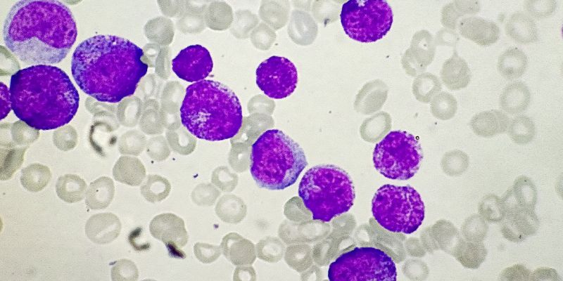 Chronic Myeloid Leukemia (CML)