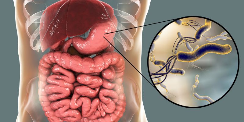 Bakteri H. pylori penyebab tukak lambung