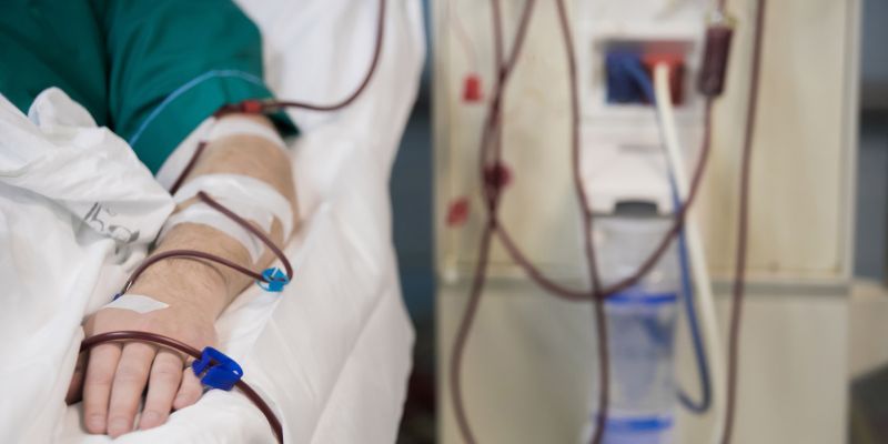 Ilustrasi Hemodialisis atau Cuci Darah