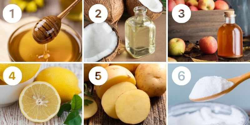 6 Cara Menghilangkan Bekas Jerawat secara Alami