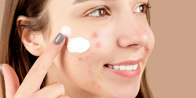 Ilustrasi Cara Mengempiskan Jerawat Batu