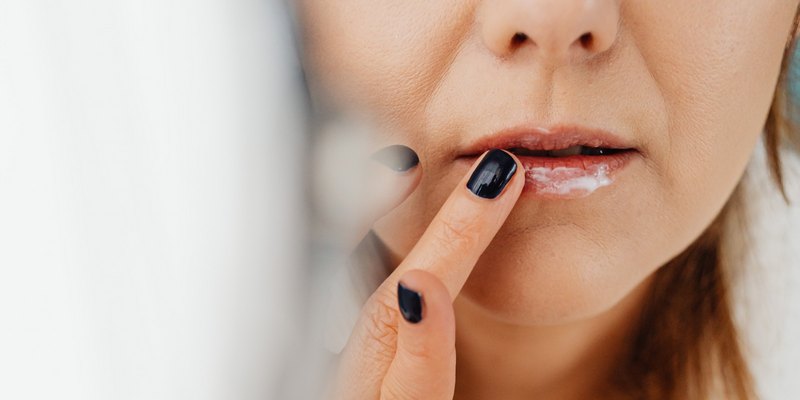 Mengatasi Penyebab Bibir Hitam